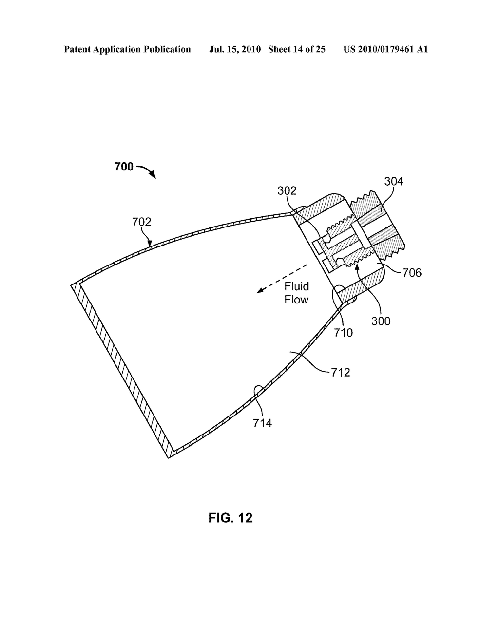 MICROBUBBLE THERAPY METHOD AND GENERATING APPARATUS - diagram, schematic, and image 15