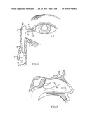 Side-by-side lacrimal intubation threader and method diagram and image