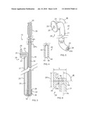 Side-by-side lacrimal intubation threader and method diagram and image