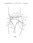 Disposable Absorbent Insert for Two-Piece Wearable Absorbent Article diagram and image