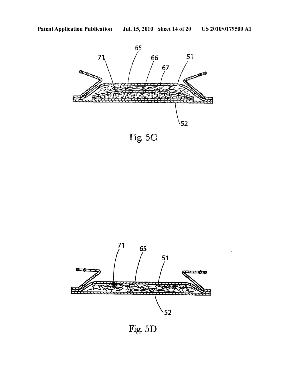 Two-Piece Wearable Absorbent Article - diagram, schematic, and image 15