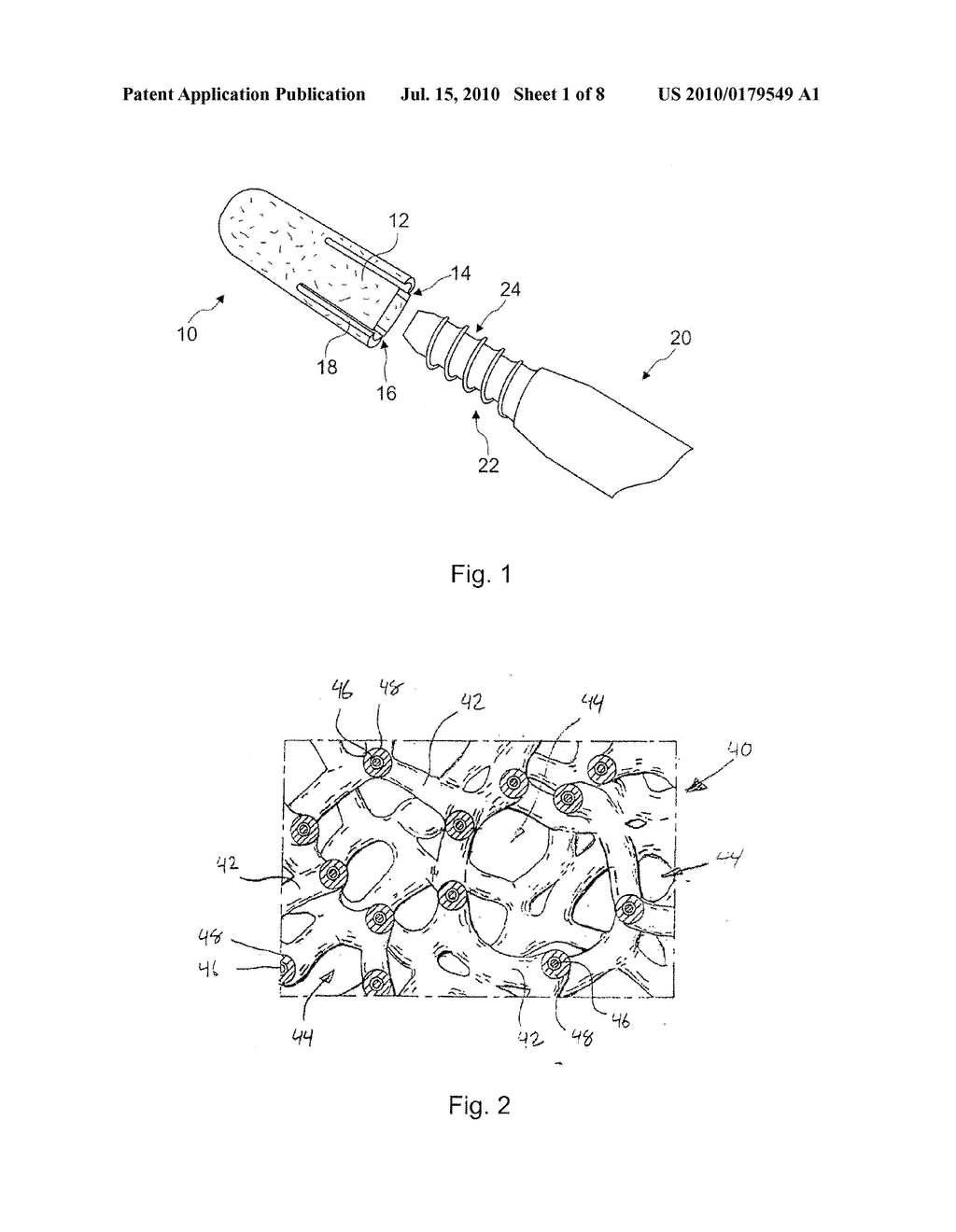 IMPLANT FOR FRACTURE TREATMENT - diagram, schematic, and image 02