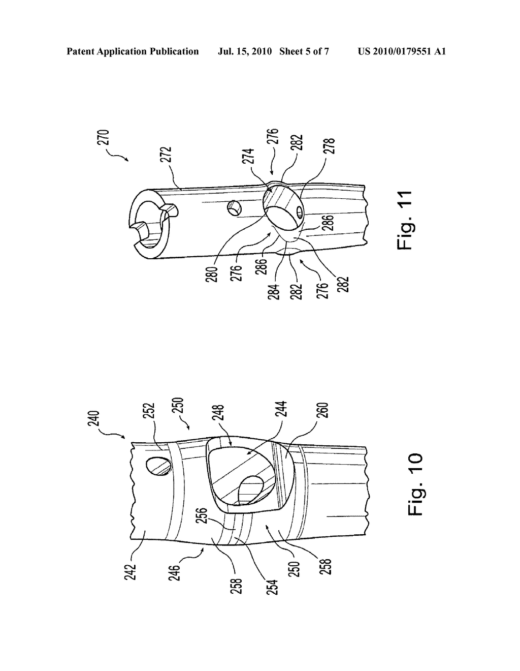 REINFORCED INTRAMEDULLARY NAIL - diagram, schematic, and image 06