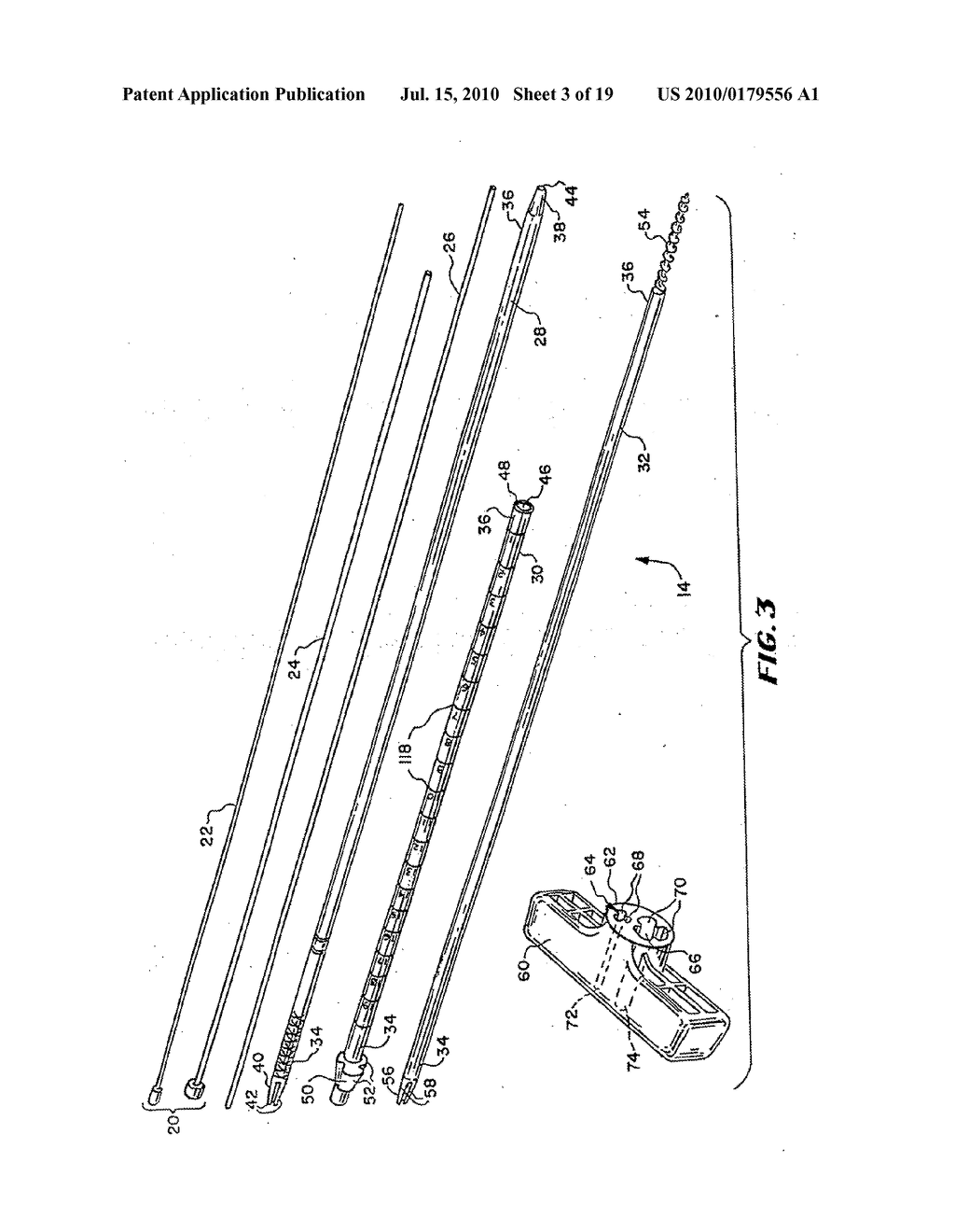 METHODS FOR PLACING MATERIALS INTO BONE - diagram, schematic, and image 04