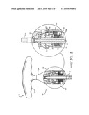 CALIBRATED MECHANICAL ORTHOPEDIC DRIVER WITH WEAR-COMPENSATED TORQUE-LIMITING MECHANISM diagram and image