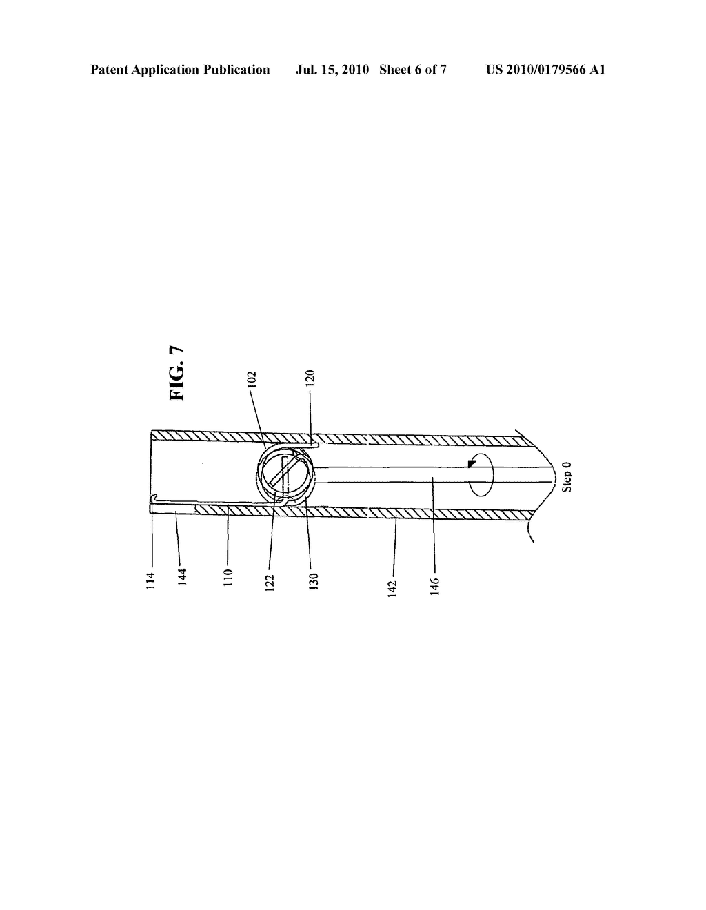 Dissecting-swatting surgical stapling device and methods of use - diagram, schematic, and image 07