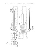 CLOSURE DEVICES, SYSTEMS, AND METHODS diagram and image