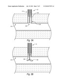 CLOSURE DEVICES, SYSTEMS, AND METHODS diagram and image