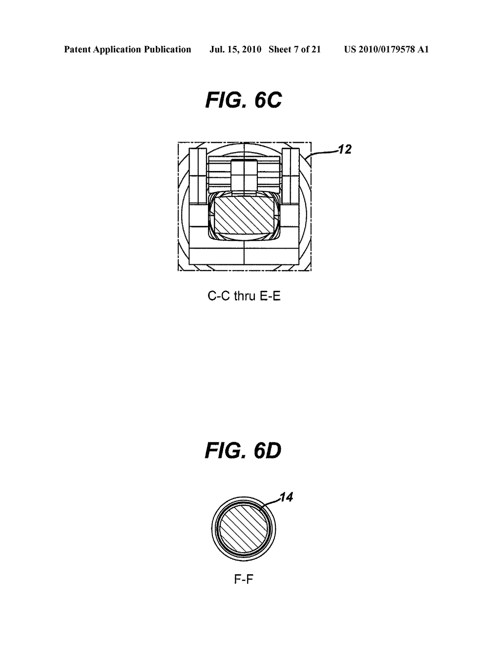 SPINAL DISC PREPARATION TOOL - diagram, schematic, and image 08