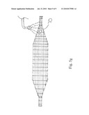 Non-Compliant Medical Balloon Having a Longitudinal Fiber Layer diagram and image