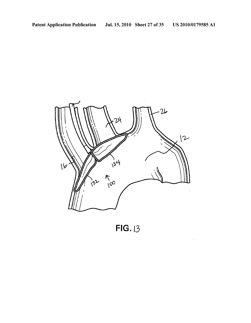 EMBOLIC DEFLECTION DEVICE - diagram, schematic, and image 28