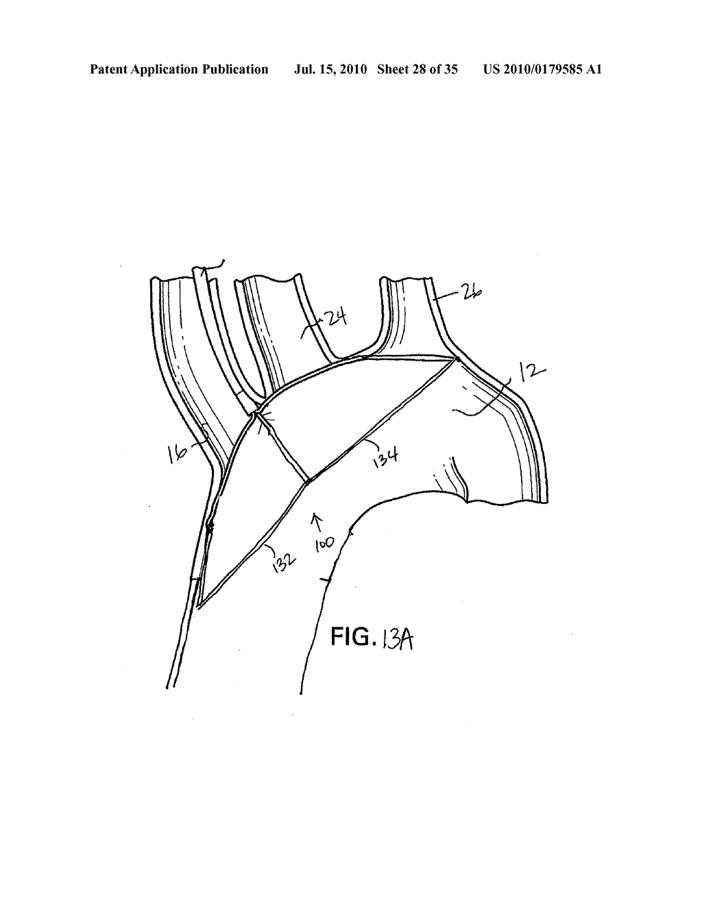 EMBOLIC DEFLECTION DEVICE - diagram, schematic, and image 29