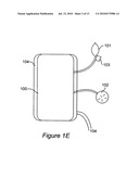 Device For Control of Difficult to Compress Hemorrhage diagram and image