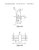 Device For Control of Difficult to Compress Hemorrhage diagram and image