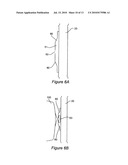 Device For Control of Difficult to Compress Hemorrhage diagram and image