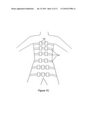 Device For Control of Difficult to Compress Hemorrhage diagram and image