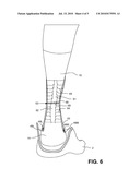 PATCH AUGMENTATION OF ACHILLES TENDON REPAIRS diagram and image