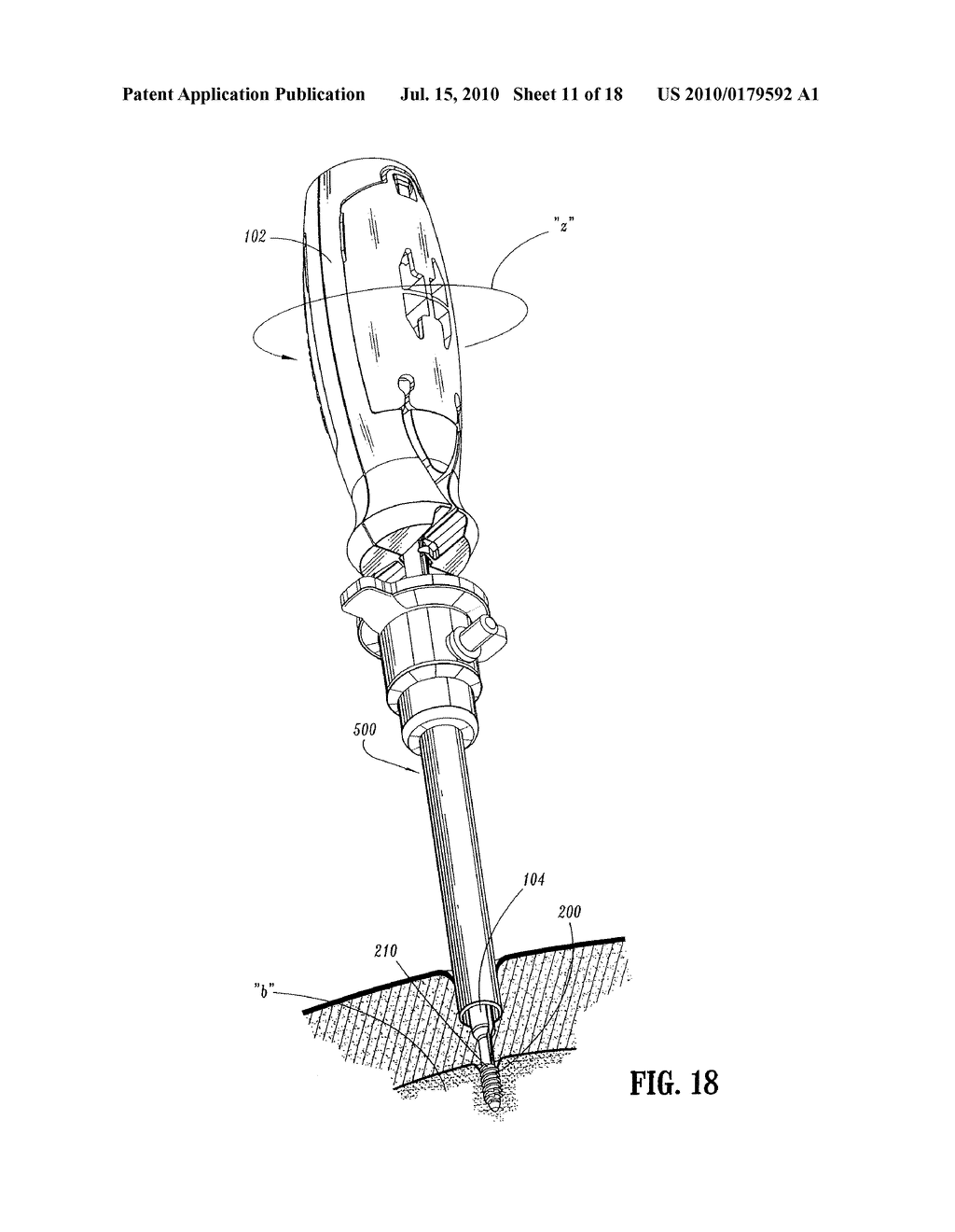 SUTURE ANCHOR INSTALLATION SYSTEM AND METHOD - diagram, schematic, and image 12