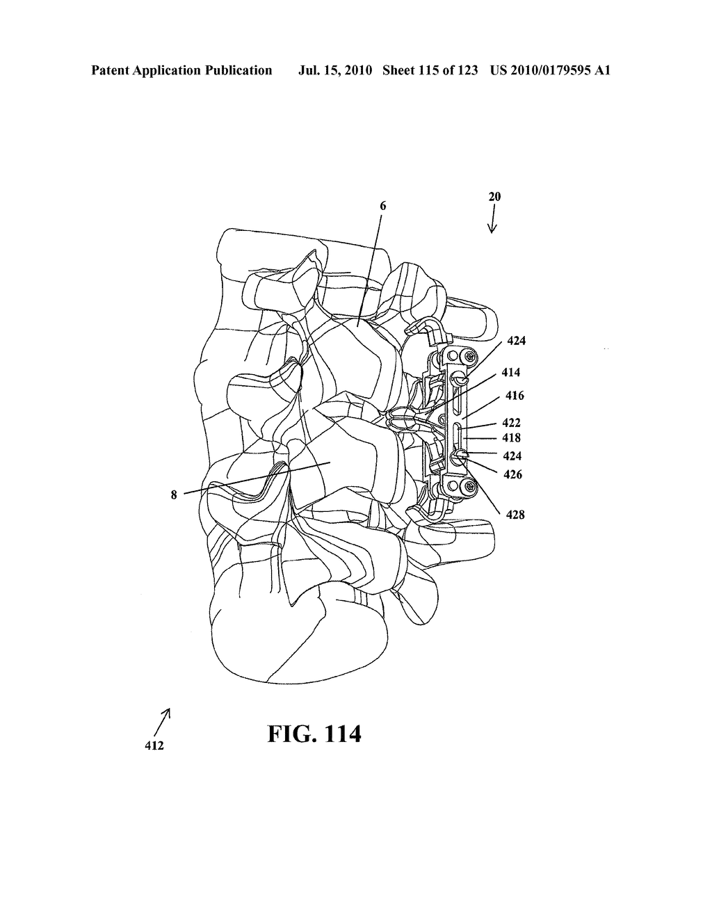 Intervertebral Implant Devices and Methods for Insertion Thereof - diagram, schematic, and image 116