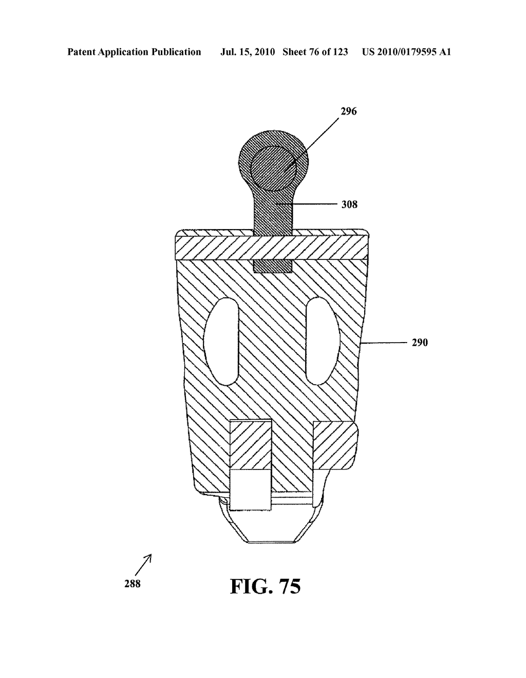 Intervertebral Implant Devices and Methods for Insertion Thereof - diagram, schematic, and image 77
