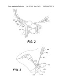 CRANIOSPINAL FUSION METHOD AND APPARATUS diagram and image