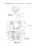 CRANIOSPINAL FUSION METHOD AND APPARATUS diagram and image