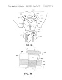 CRANIOSPINAL FUSION METHOD AND APPARATUS diagram and image