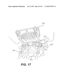 CRANIOSPINAL FUSION METHOD AND APPARATUS diagram and image