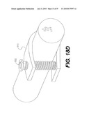 CRANIOSPINAL FUSION METHOD AND APPARATUS diagram and image