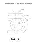 CRANIOSPINAL FUSION METHOD AND APPARATUS diagram and image