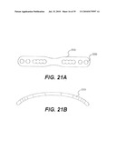 CRANIOSPINAL FUSION METHOD AND APPARATUS diagram and image