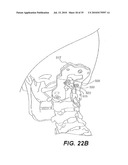 CRANIOSPINAL FUSION METHOD AND APPARATUS diagram and image