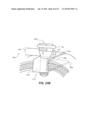 CRANIOSPINAL FUSION METHOD AND APPARATUS diagram and image