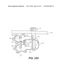 CRANIOSPINAL FUSION METHOD AND APPARATUS diagram and image