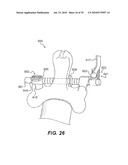 CRANIOSPINAL FUSION METHOD AND APPARATUS diagram and image