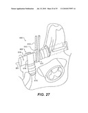 CRANIOSPINAL FUSION METHOD AND APPARATUS diagram and image