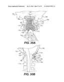 CRANIOSPINAL FUSION METHOD AND APPARATUS diagram and image