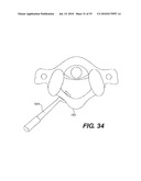 CRANIOSPINAL FUSION METHOD AND APPARATUS diagram and image