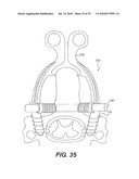 CRANIOSPINAL FUSION METHOD AND APPARATUS diagram and image