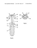 METHOD FOR LOCKING AN ARTIFICIAL FACET BETWEEN TWO VERTEBRAL BODIES diagram and image