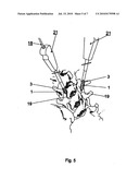 METHOD FOR LOCKING AN ARTIFICIAL FACET BETWEEN TWO VERTEBRAL BODIES diagram and image