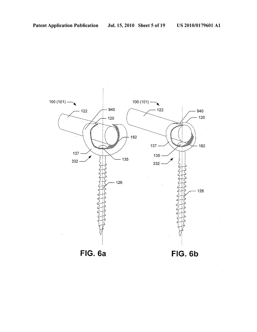 Threadless position augmenting mechanism - diagram, schematic, and image 06