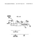 IMPLANTABLE ACOUSTIC SENSOR diagram and image