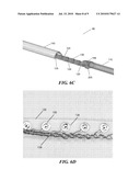 Medical Lead Termination Sleeve for Implantable Medical Devices diagram and image