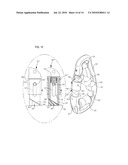 SNAP RING HAVING MULTIPLE ROLLERS diagram and image