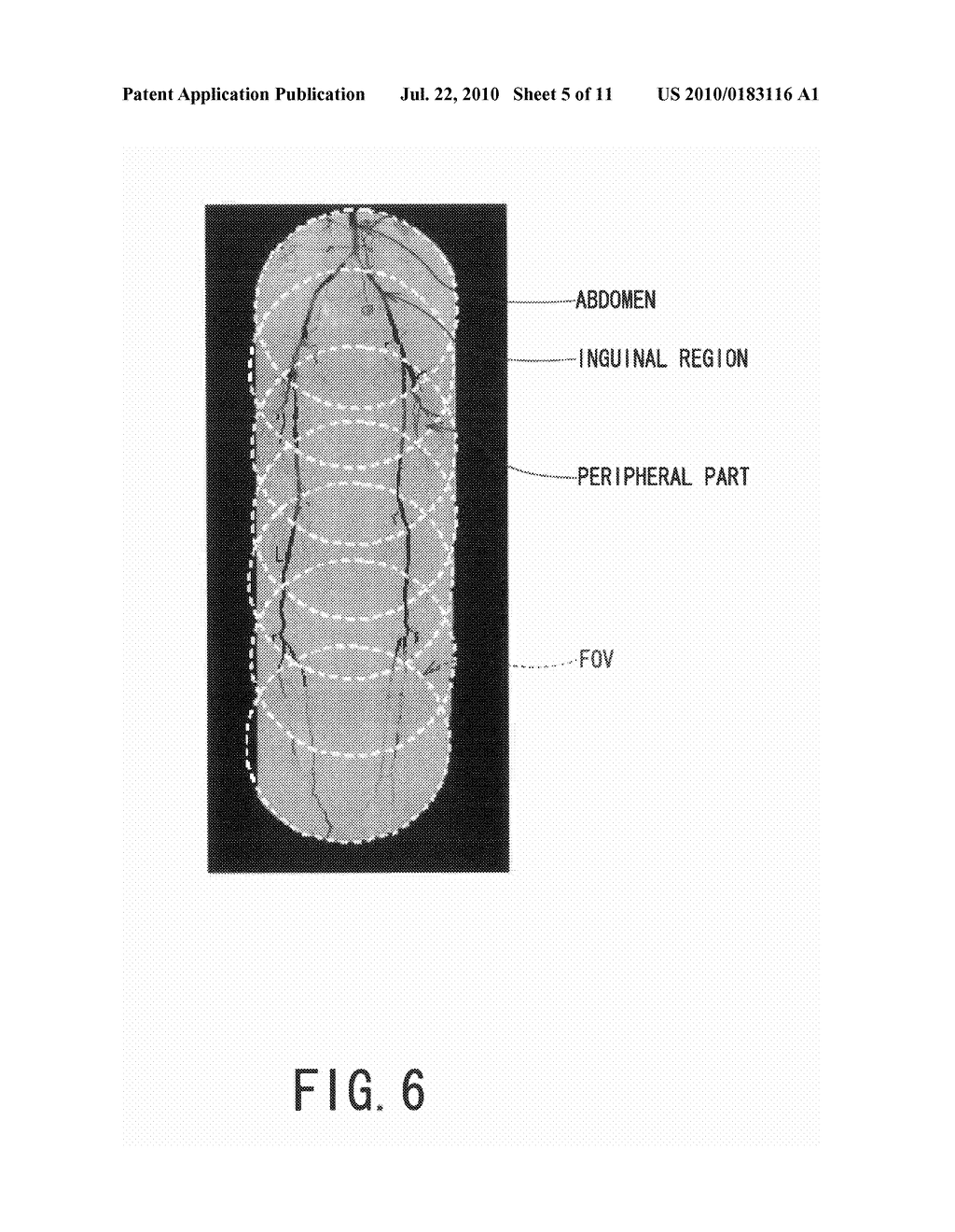 X-RAY IMAGE DIAGNOSING APPARATUS, AND CONTROLLING METHOD OF X-RAY IMAGE DIAGNOSING APPARATUS - diagram, schematic, and image 06