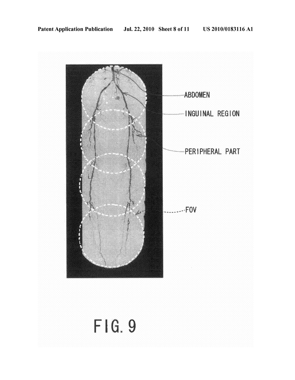 X-RAY IMAGE DIAGNOSING APPARATUS, AND CONTROLLING METHOD OF X-RAY IMAGE DIAGNOSING APPARATUS - diagram, schematic, and image 09