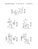 Gated Radiation Procedure Using Packages diagram and image