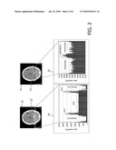 DETECTING HAEMORRHAGIC STROKE IN CT IMAGE DATA diagram and image