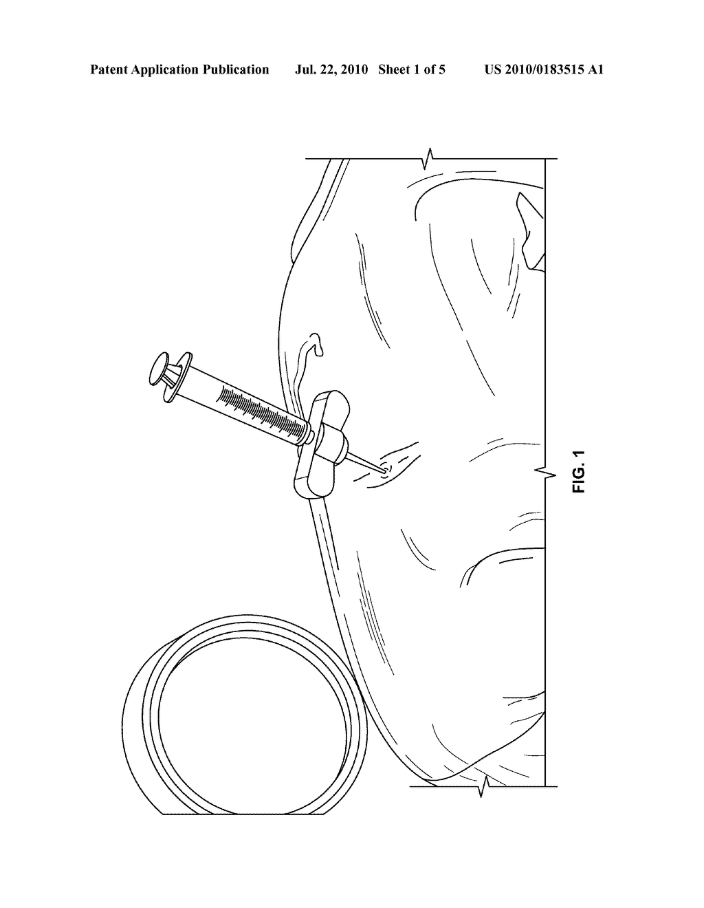 COMPOSITIONS AND METHODS FOR TREATING THE VERTEBRAL COLUMN - diagram, schematic, and image 02